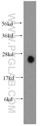 ARD1A Antibody in Western Blot (WB)