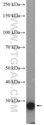 ARD1A Antibody in Western Blot (WB)