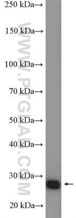 ARD1A Antibody in Western Blot (WB)