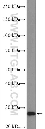 ARD1A Antibody in Western Blot (WB)