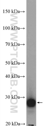 ARD1A Antibody in Western Blot (WB)