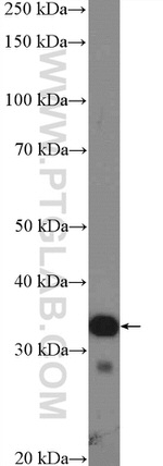 EXOSC2 Antibody in Western Blot (WB)