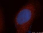 EXOSC2 Antibody in Immunocytochemistry (ICC/IF)