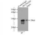 DCUN1D5 Antibody in Immunoprecipitation (IP)