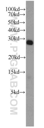 DCUN1D5 Antibody in Western Blot (WB)