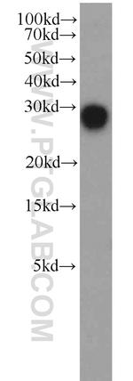 DCUN1D5 Antibody in Western Blot (WB)