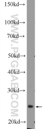 DCUN1D5 Antibody in Western Blot (WB)