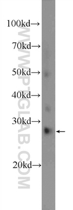 DCUN1D5 Antibody in Western Blot (WB)