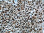 HNRNPA2B1 Antibody in Immunohistochemistry (Paraffin) (IHC (P))