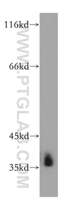 HNRNPA2B1 Antibody in Western Blot (WB)