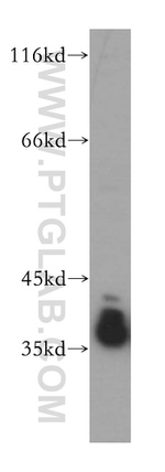 HNRNPA2B1 Antibody in Western Blot (WB)