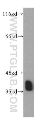 HNRNPA2B1 Antibody in Western Blot (WB)