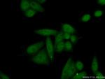HNRNPA2B1 Antibody in Immunocytochemistry (ICC/IF)