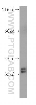 HNRNPA2B1 Antibody in Western Blot (WB)