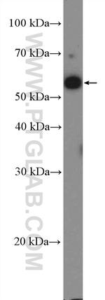 ZNF207 Antibody in Western Blot (WB)