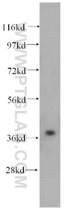 PEX16 Antibody in Western Blot (WB)