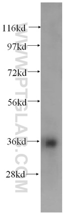 HMOX2 Antibody in Western Blot (WB)