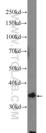 HMOX2 Antibody in Western Blot (WB)