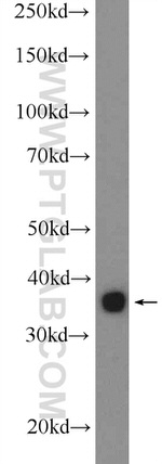 HMOX2 Antibody in Western Blot (WB)