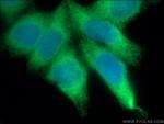 HMOX2 Antibody in Immunocytochemistry (ICC/IF)