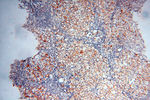 MICAL1 Antibody in Immunohistochemistry (Paraffin) (IHC (P))