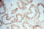 MICAL1 Antibody in Immunohistochemistry (Paraffin) (IHC (P))