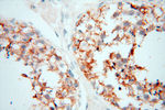 MICAL1 Antibody in Immunohistochemistry (Paraffin) (IHC (P))