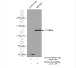 MICAL1 Antibody in Immunoprecipitation (IP)