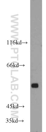 GPR37/Pael-R Antibody in Western Blot (WB)