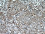 GIPC1 Antibody in Immunohistochemistry (Paraffin) (IHC (P))