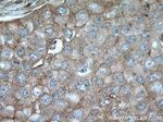 GIPC1 Antibody in Immunohistochemistry (Paraffin) (IHC (P))