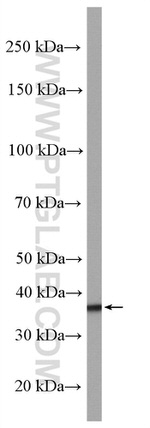 GIPC1 Antibody in Western Blot (WB)