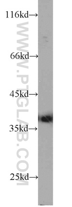 ARG2 Antibody in Western Blot (WB)