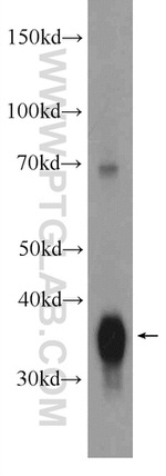 ARG2 Antibody in Western Blot (WB)