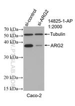 ARG2 Antibody in Western Blot (WB)