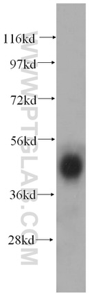PCYT2 Antibody in Western Blot (WB)
