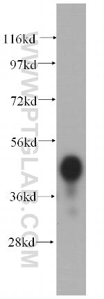 PCYT2 Antibody in Western Blot (WB)