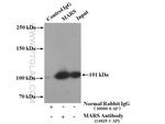 MARS Antibody in Immunoprecipitation (IP)