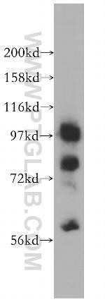 MARS Antibody in Western Blot (WB)