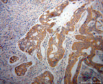 UMPS Antibody in Immunohistochemistry (Paraffin) (IHC (P))