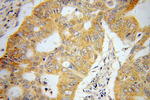 UMPS Antibody in Immunohistochemistry (Paraffin) (IHC (P))