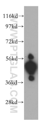 UMPS Antibody in Western Blot (WB)