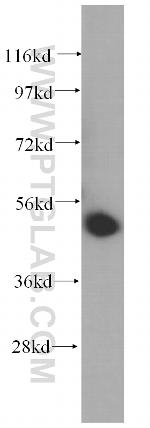 UMPS Antibody in Western Blot (WB)