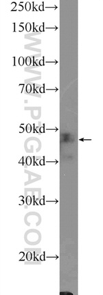 UMPS Antibody in Western Blot (WB)