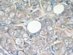 ATF2 Antibody in Immunohistochemistry (Paraffin) (IHC (P))