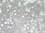 ATF2 Antibody in Immunohistochemistry (Paraffin) (IHC (P))