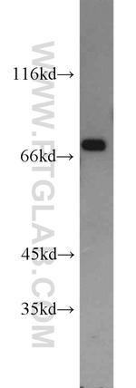 ATF2 Antibody in Western Blot (WB)