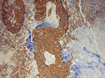 UBC9 Antibody in Immunohistochemistry (Paraffin) (IHC (P))