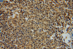 UBC9 Antibody in Immunohistochemistry (Paraffin) (IHC (P))