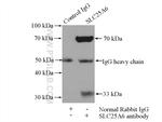 SLC25A6 Antibody in Immunoprecipitation (IP)